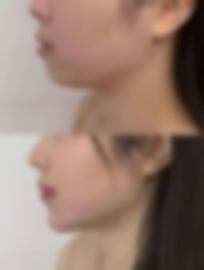 韩国ILOVE整形外科资质