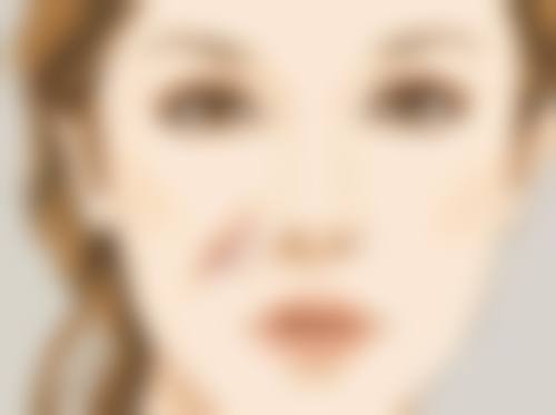 哪种隆鼻方式比较好？硅胶假体VS自体软骨，权威医院技术大PK