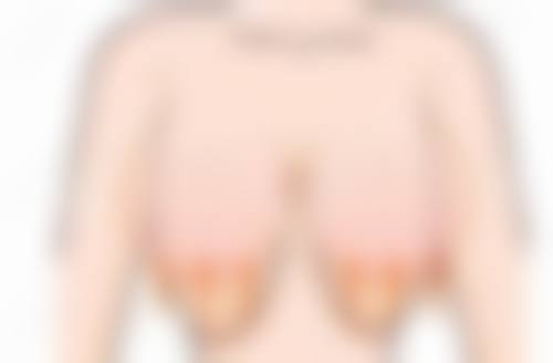 黄拔瑞医生口碑如何