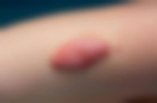 鸡西御美整形医院项目特色