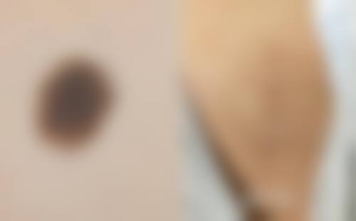 杭州铸梦嘉妍医疗美容诊所更擅长什么手术