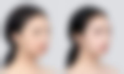 平行双眼皮适合新月眼型吗——新月眼遇上平行双眼皮，风格抉择的难题