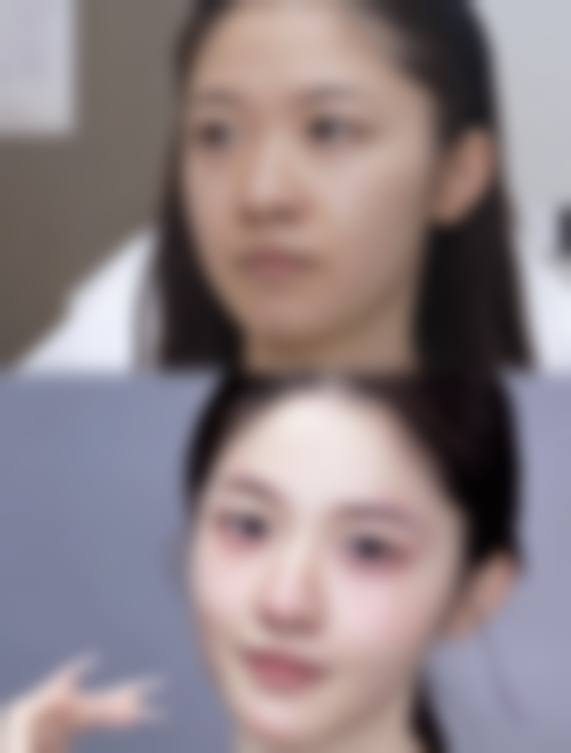 3岁小孩脸上疤痕慢慢能修复吗？浅疤可自然消退，深疤需及时治疗