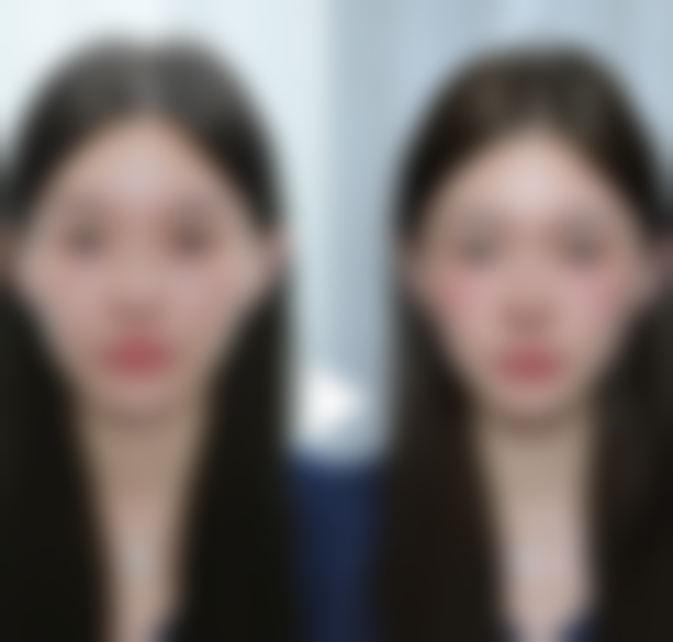 3岁小孩脸上疤痕修复至佳时间的科学选择