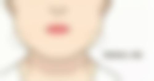 倪炜医生简介口碑如何