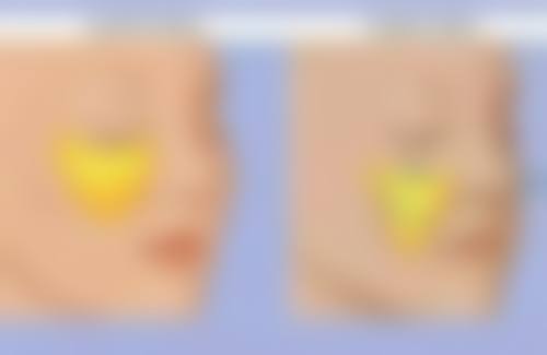 胡丹医生项目优势