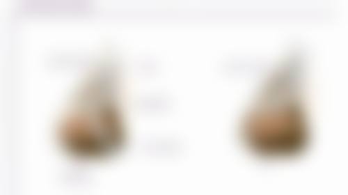 隆鼻线提升不取出的潜在危害