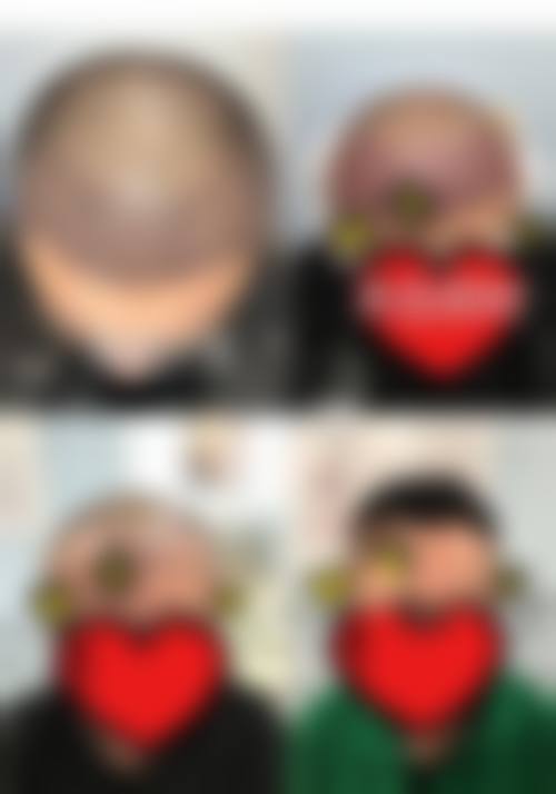 长沙希美医疗美容医院口碑好不好？附真实患者口碑评价