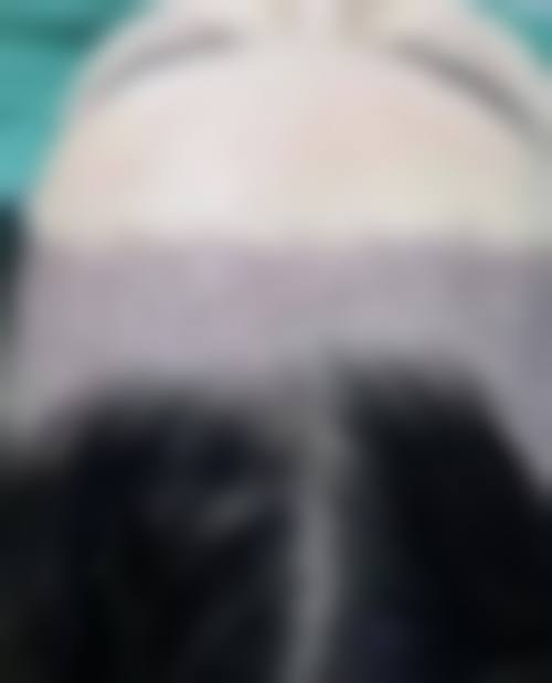 南通新生植发怎么样，资质如何？