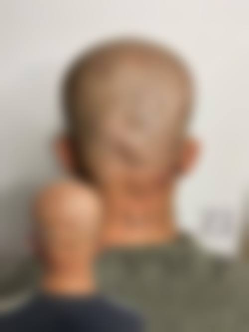 南通新生植发怎么样，医生简介