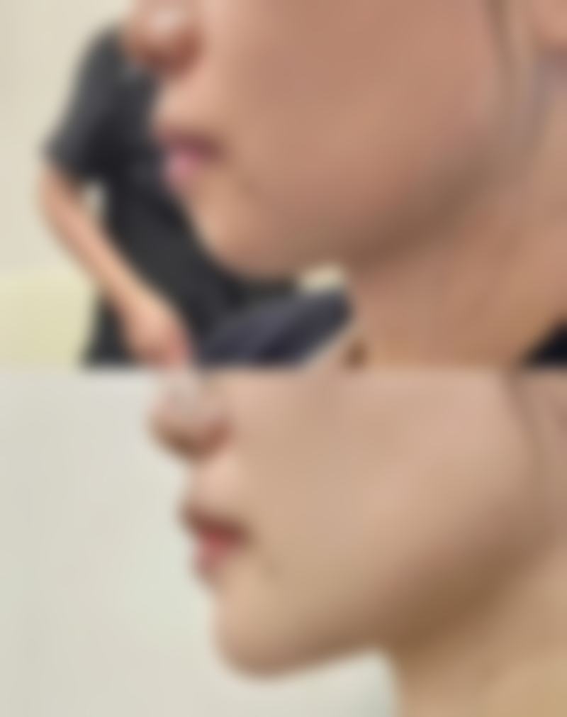 胡丹医生做手术价格