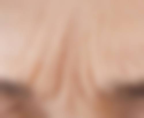 割双眼皮改善眼皮松弛的适合人群