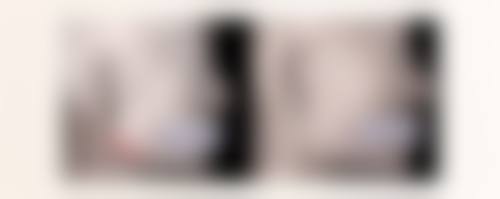 怎么知道自己通过手术是双眼皮