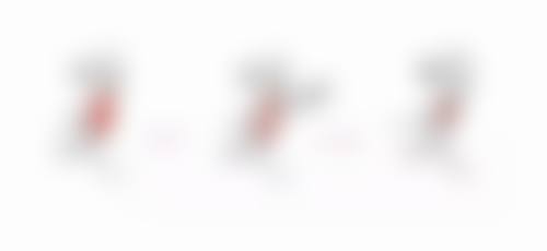 割双眼皮可以改善眼皮松弛吗？全切法紧致效果更持久，恢复期1-3个月