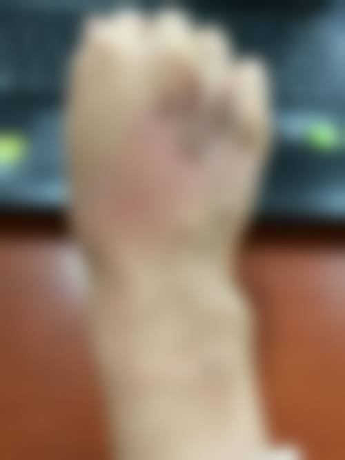 杭州悦可医疗美容诊所熊员平医生患者口碑好不好