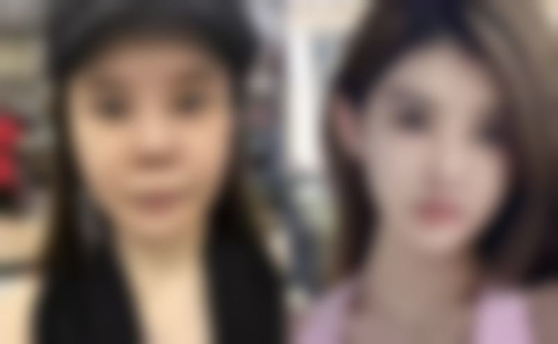 彭艳医生做手术价格