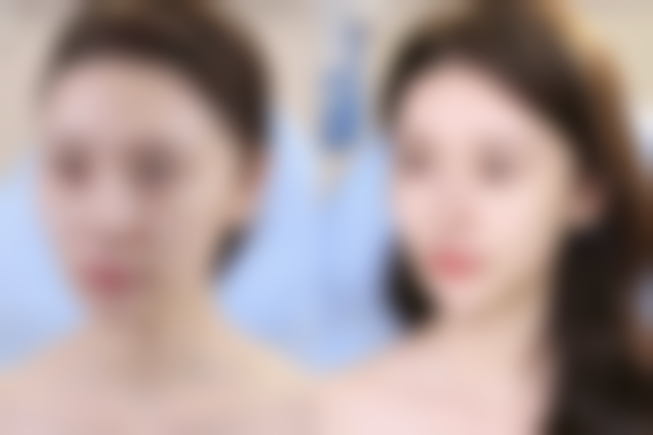 胡以信医生简介口碑如何