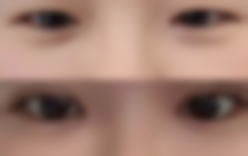 胡以信医生简介做手术价格