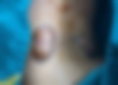 张明锐医生顾客实例图片