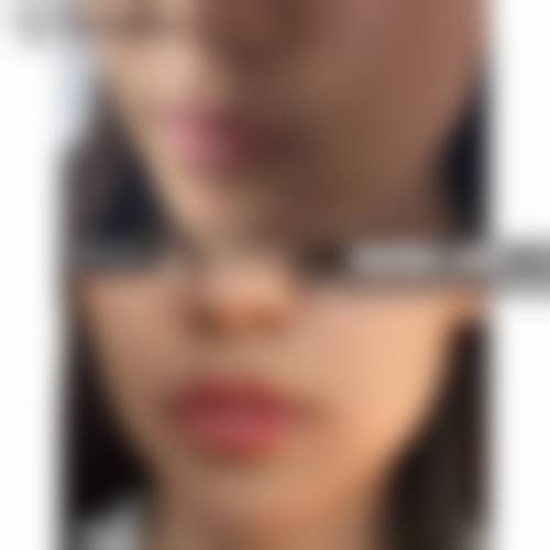 润州华俪整形医院怎么样之真实患者口碑评价