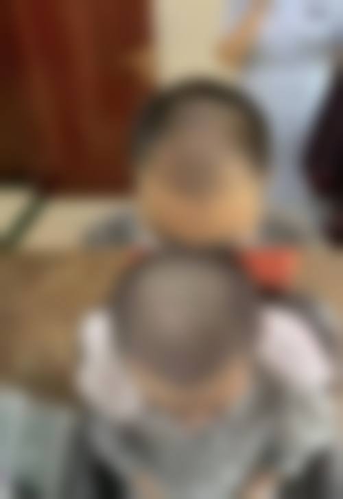 许昌正美韶华医疗整形郝文玉是否有失败实例——许昌第五人民医院整形美容外科