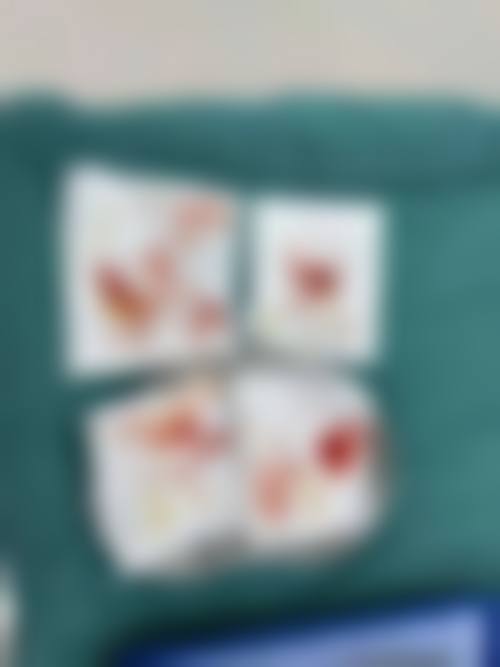 运城丽霞医疗整形美容诊所价格表