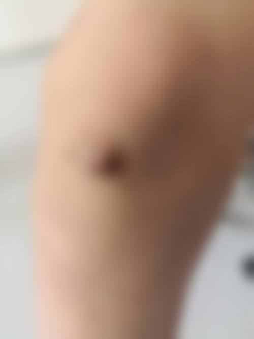 巢湖丽肤中医和西医结合门诊部医疗美容科价格表