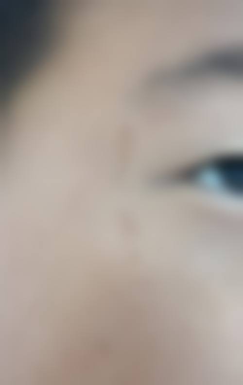 运城丽霞医疗整形美容诊所更擅长什么手术