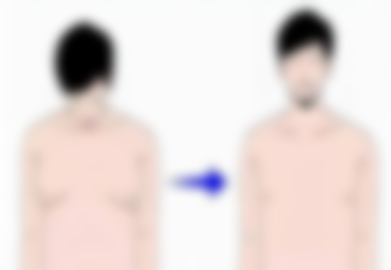 烫伤后多年留下的疤痕会消掉吗？陈旧疤痕的改善之道