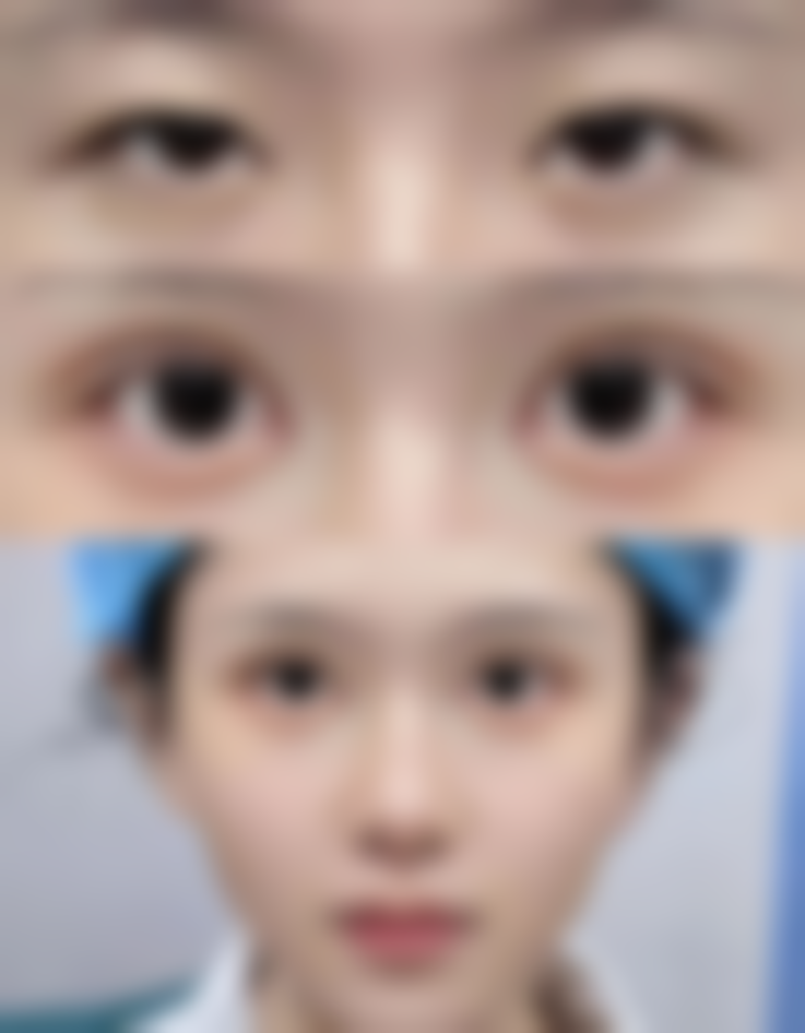 宾玉琴医生简介之项目优势