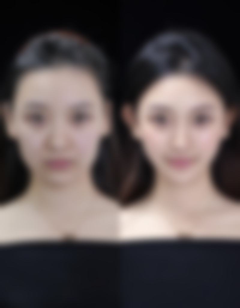 赵晓阳医生项目优势解读