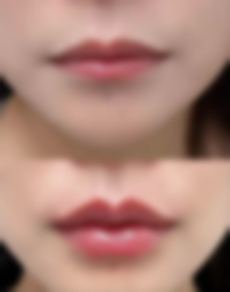 廖琼医生简介口碑如何：多医院高口碑评价