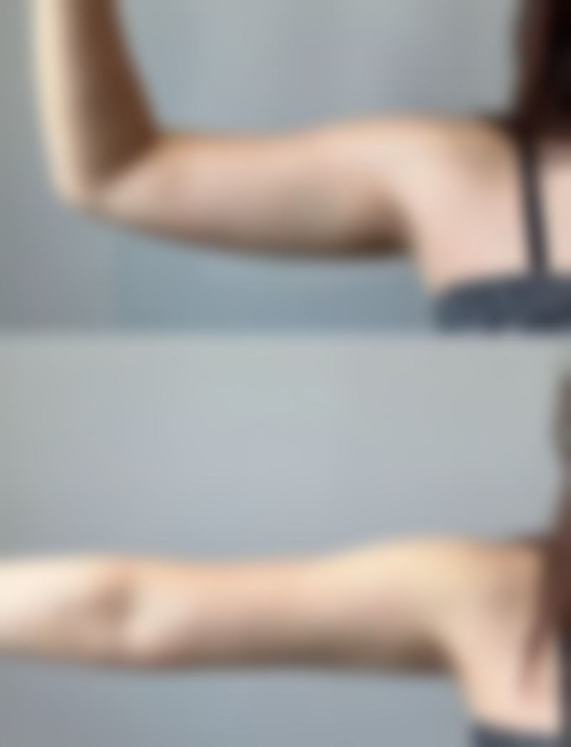 刘静雅医生简介口碑如何