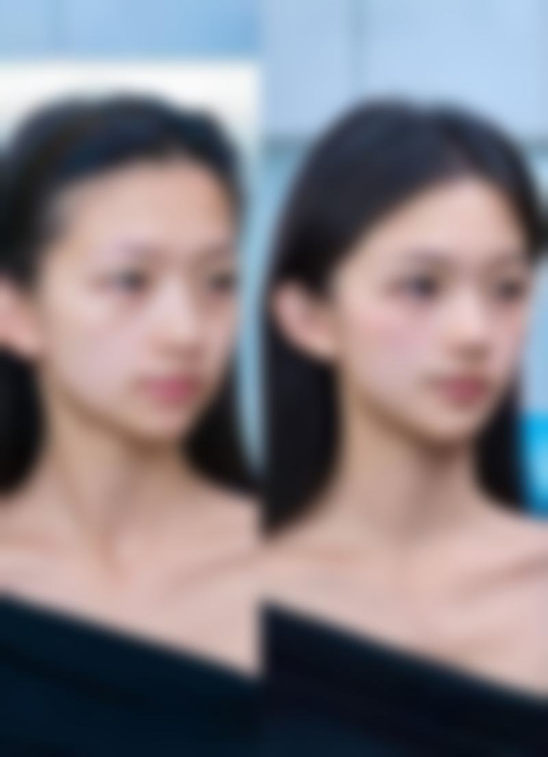 一次除皱针能维持多久：眼部除皱针3 - 6个月的“电眼守护者”