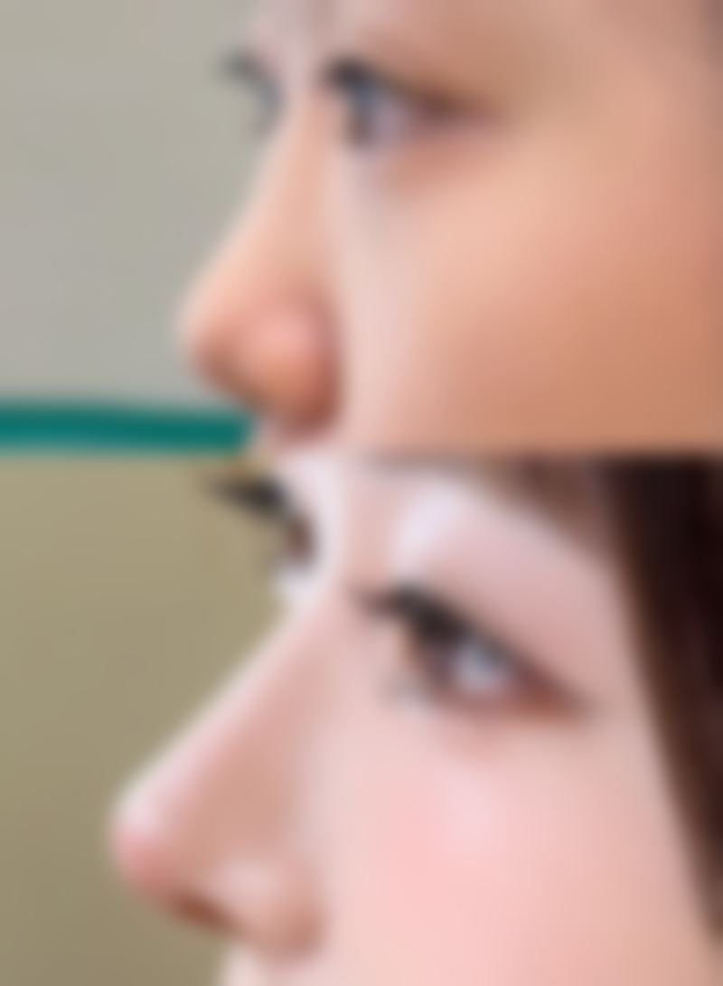 黄余芝医生简介做手术价格