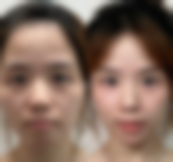 黄余芝医生简介项目优势