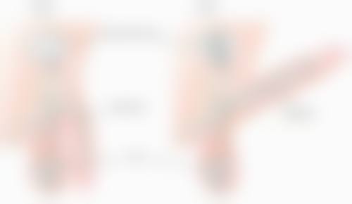 上海抽脂去眼袋特色：精细与创新并存