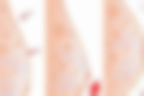 北京悦秀医疗美容怎么样高海燕医生的优势