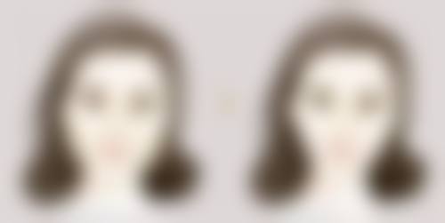 国有vs私立医院：抽脂去眼袋的选择难题