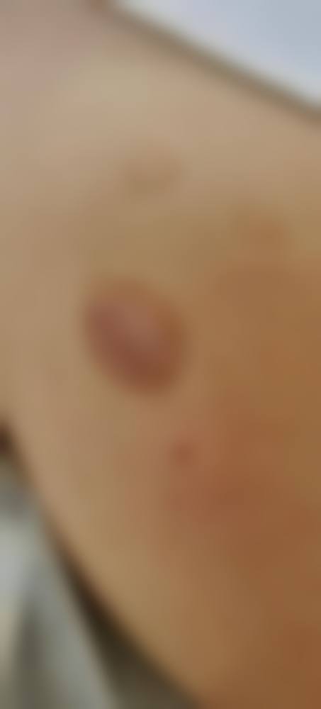 常州常美整形医院项目特色