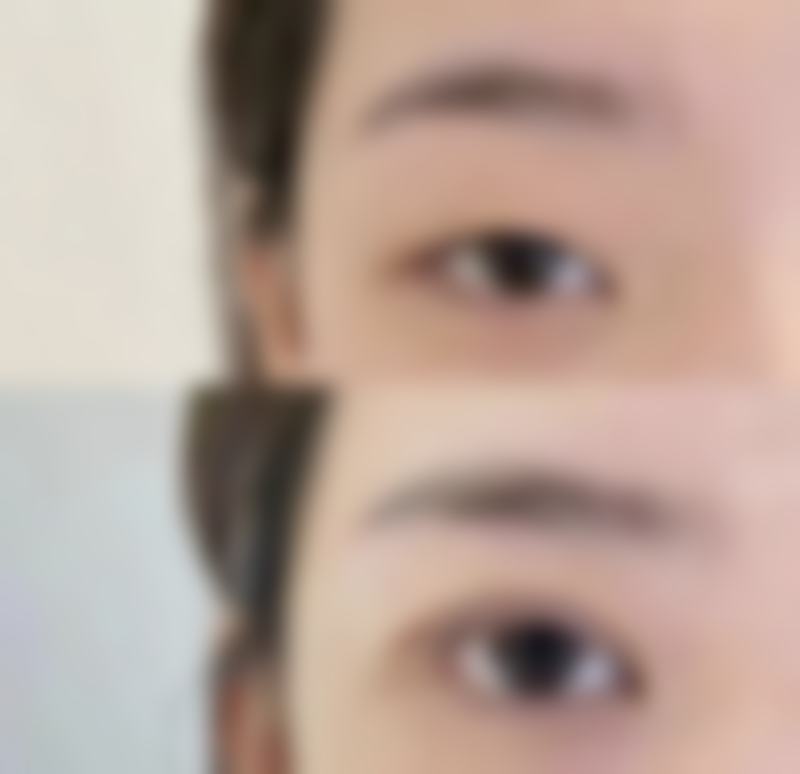 黄雄飞医生简介项目优势