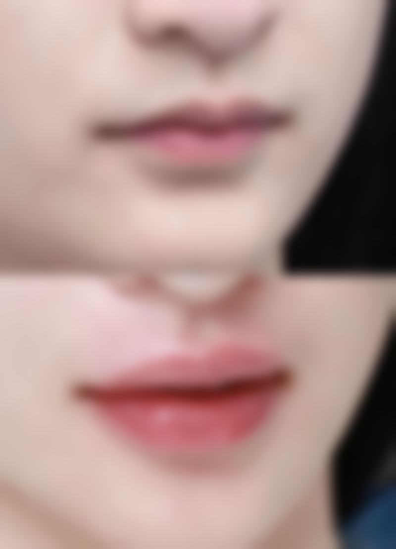 南京哪个隆鼻比较好——南京隆鼻医生红榜