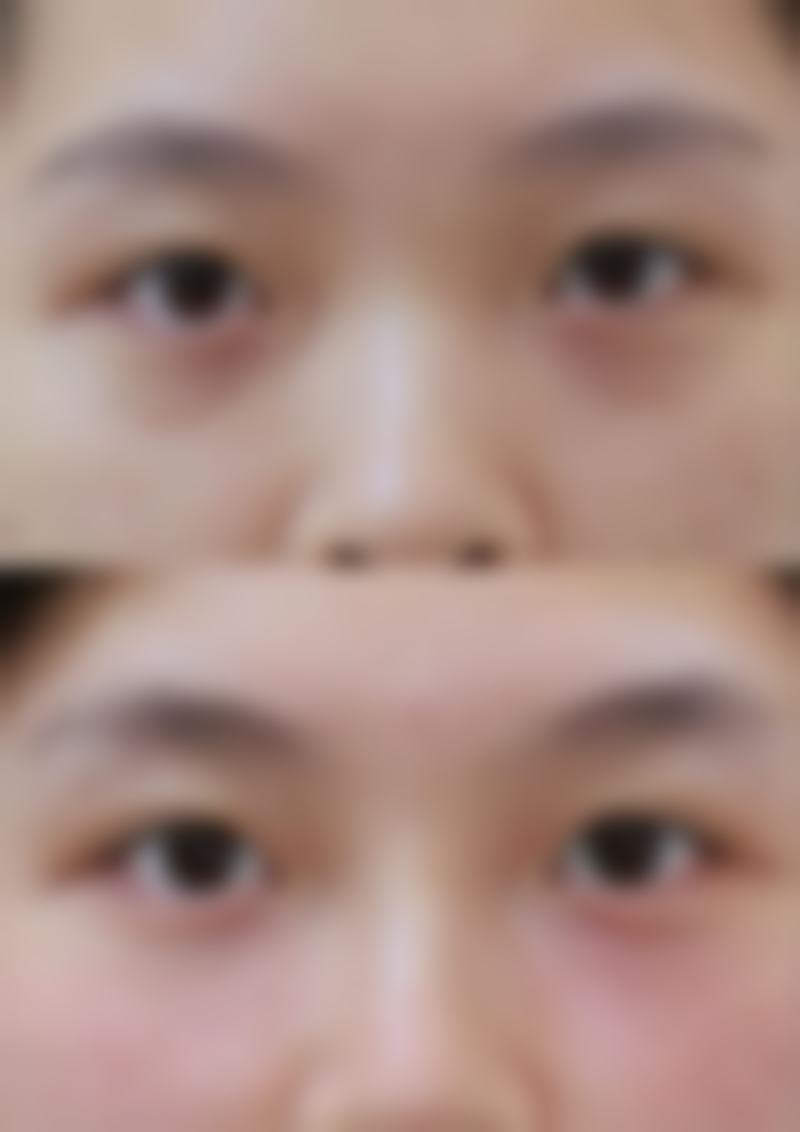 南京哪个隆鼻比较好？公立三甲VS私立名医，这份避坑指南请收好