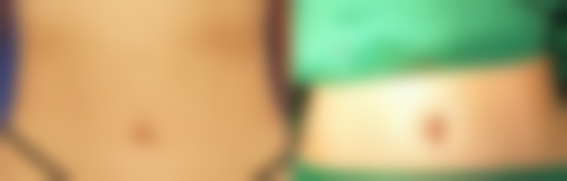 涂抹丰太阳穴的三大风险：你可能没想到