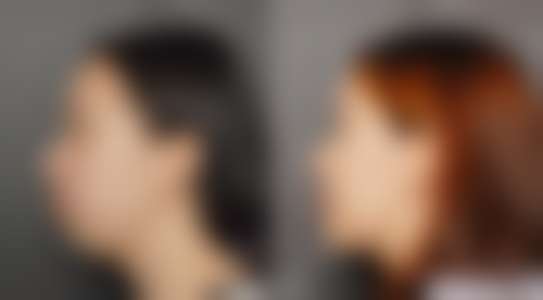 韩国迪美整形外科抖音团购及价格表