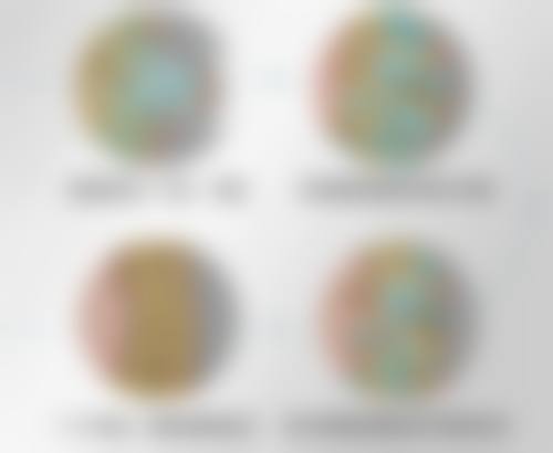 全身抽脂怎么抽的之麻醉方式选择