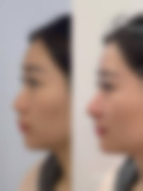 胡瑞芬医生项目优势