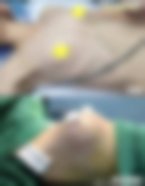 韩国清潭Areum Clinic正规吗?特色项目有哪些