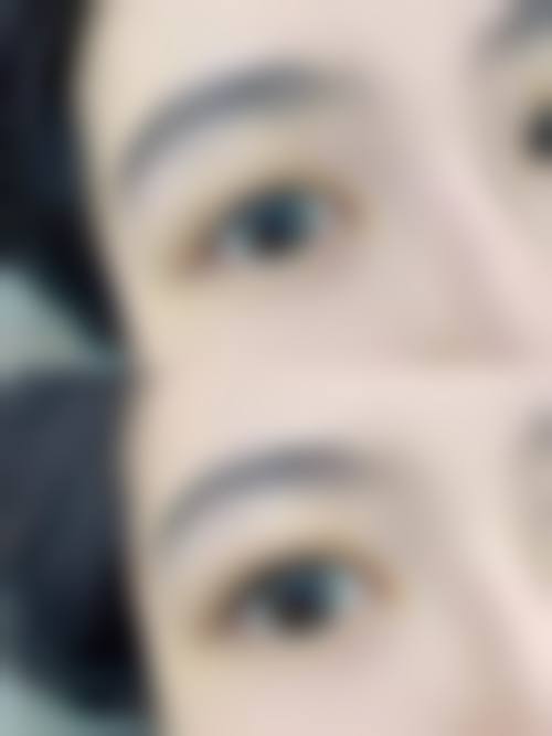 南通英莎医疗美容门诊部李辉做过的真实反馈——南通伯思立美容医院