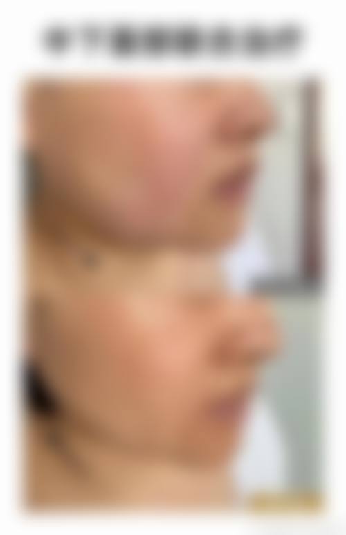 八、浙江美福宝妇儿整形医院价格表